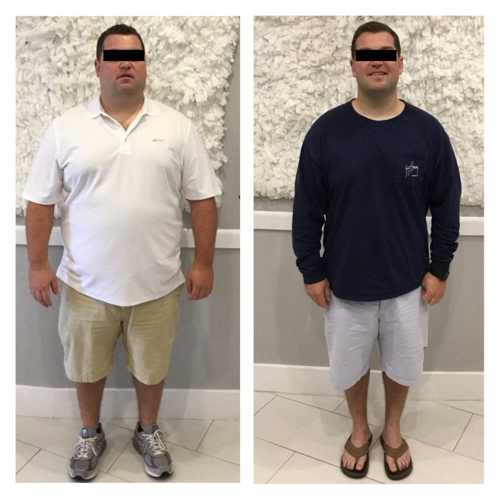 Weight Loss Before & After