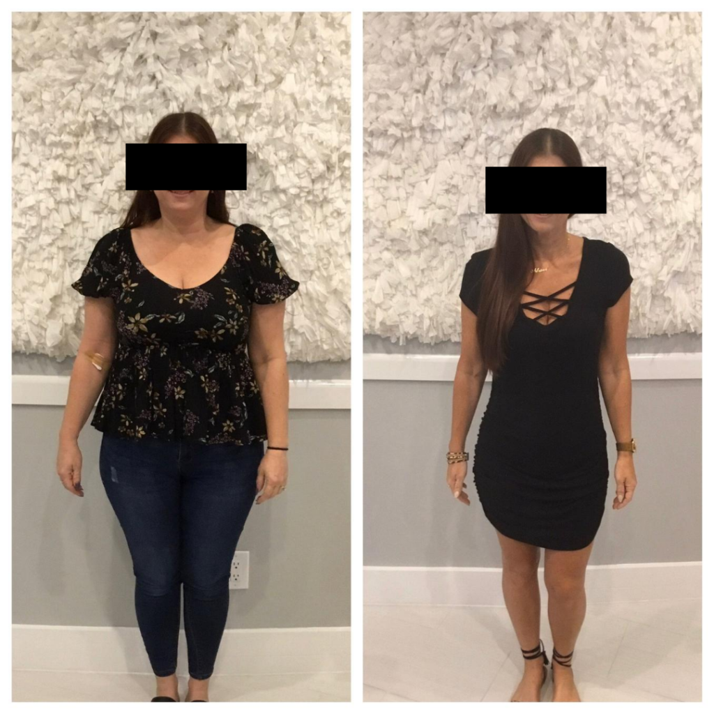 Weight Loss Before & After