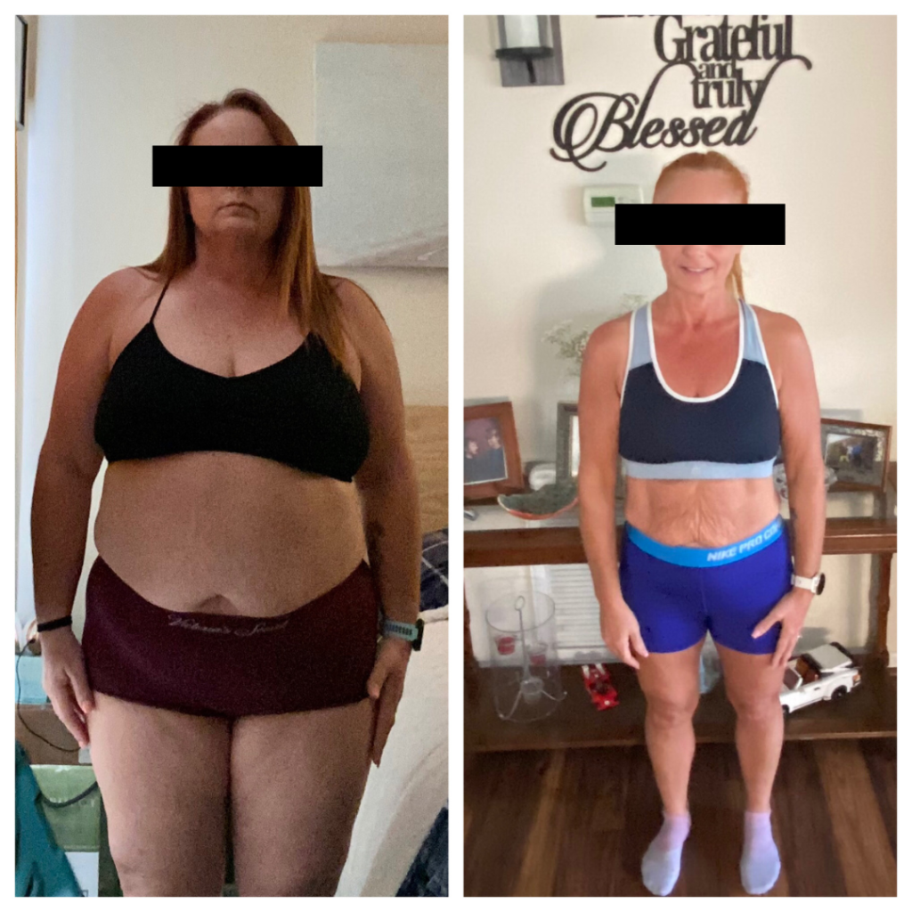 Semaglutide, Weight Loss Before & After